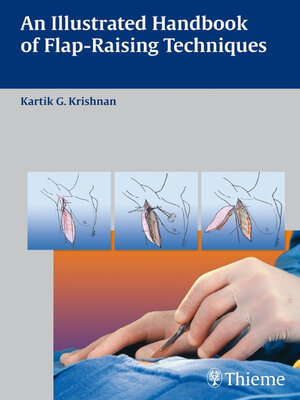 cover image of An Illustrated Handbook of Flap-Raising Techniques